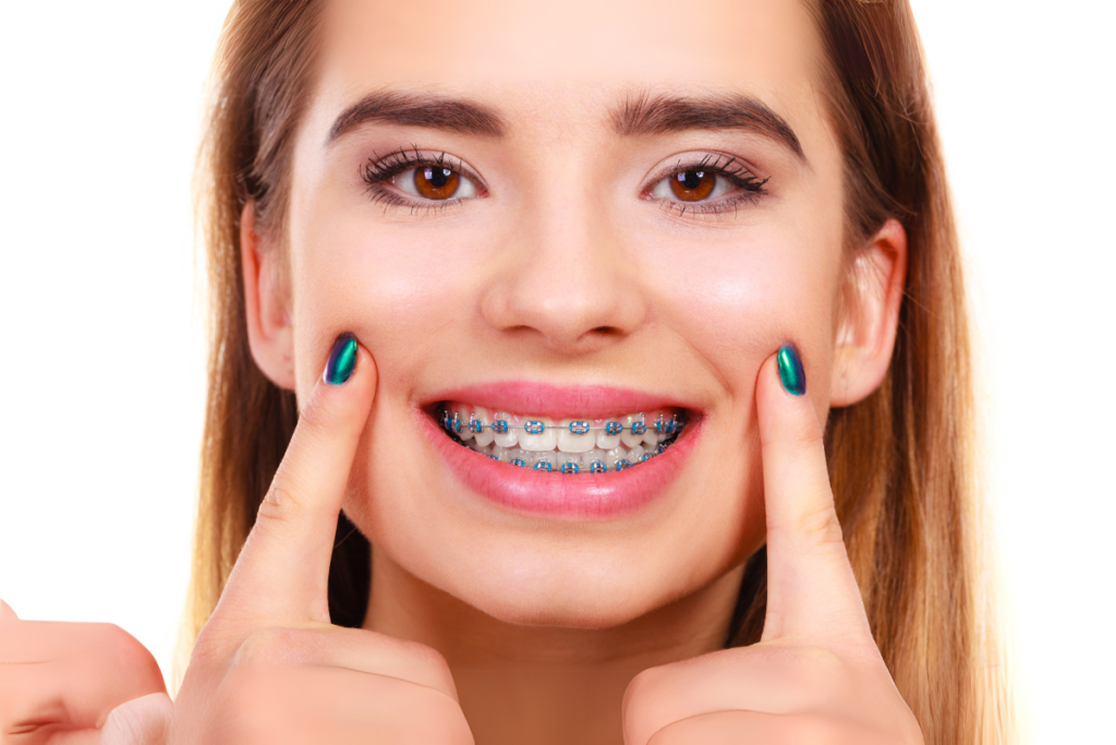 Braces