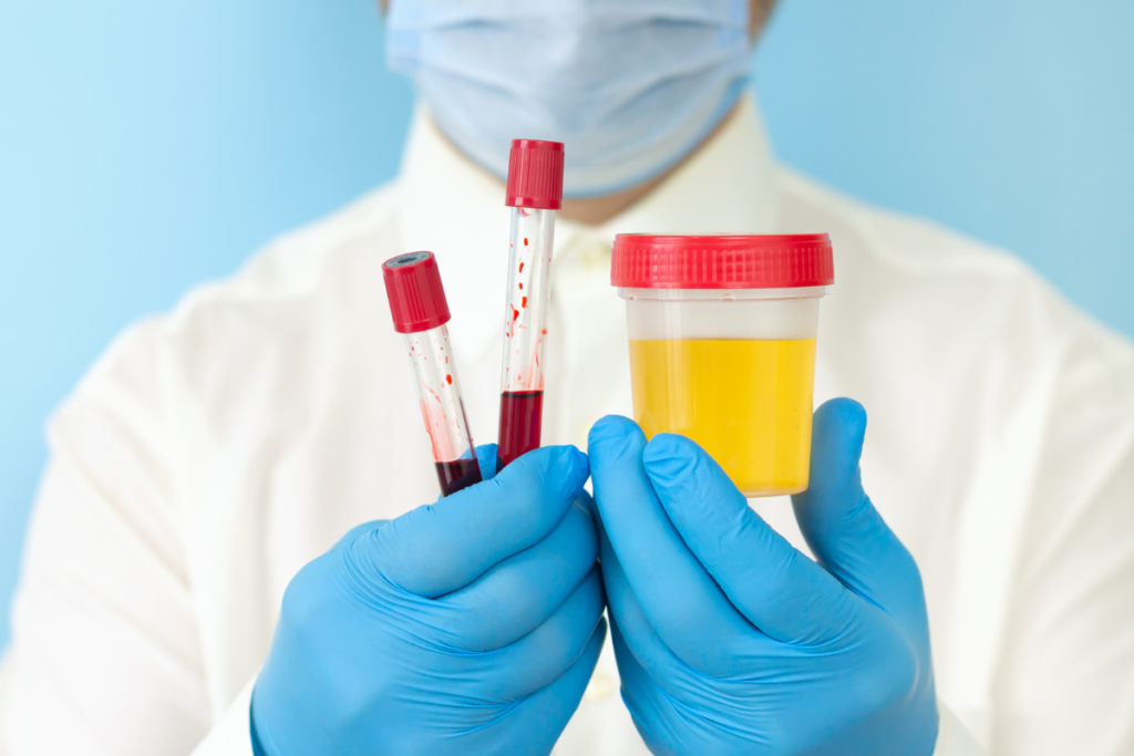 Glomerulonephritis