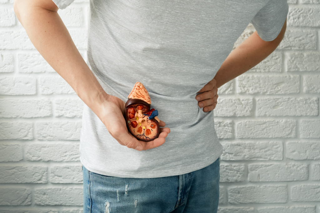 Kidney stones