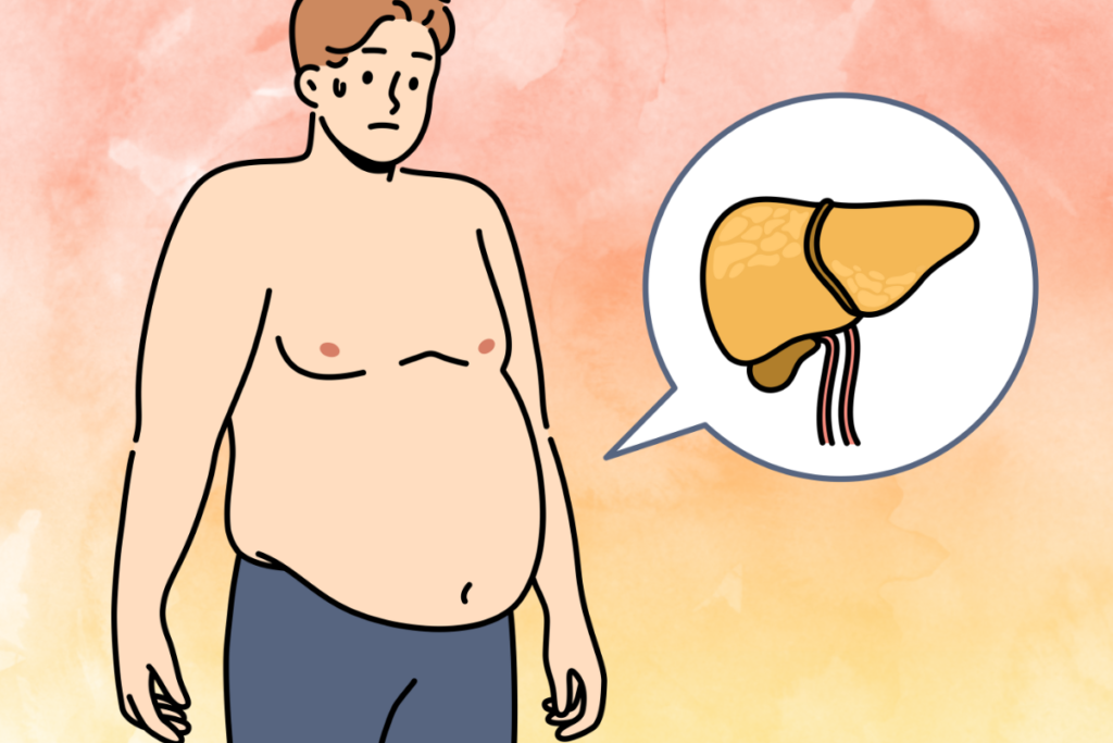 Liver Cirrhosis