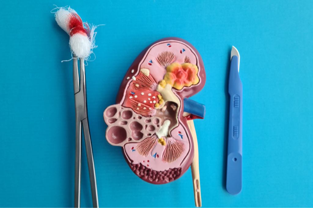 Renal transpalantation