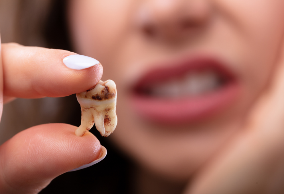 The Impact of Wisdom Teeth_ To Remove or Not to Remove