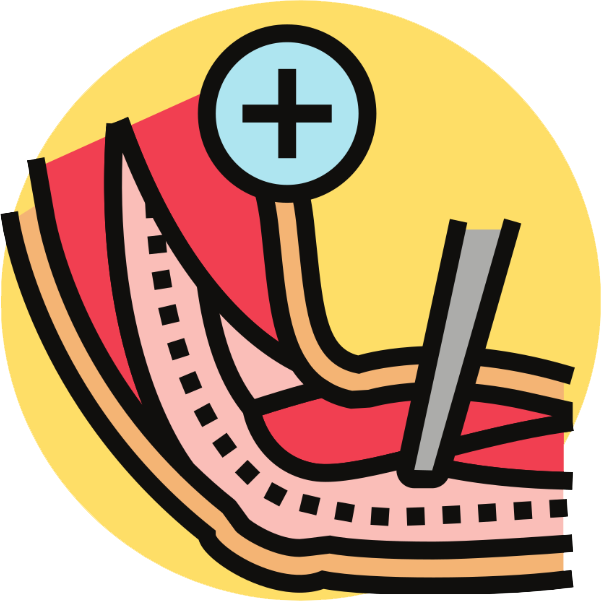 Electromyography