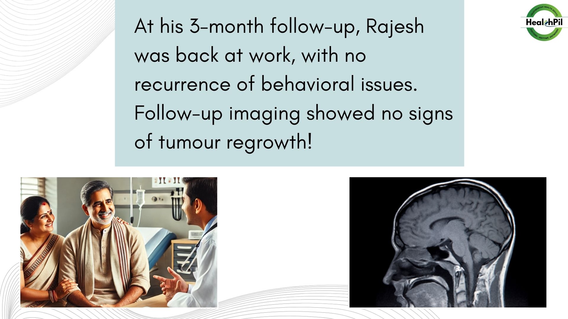 Frontal lobe tumor