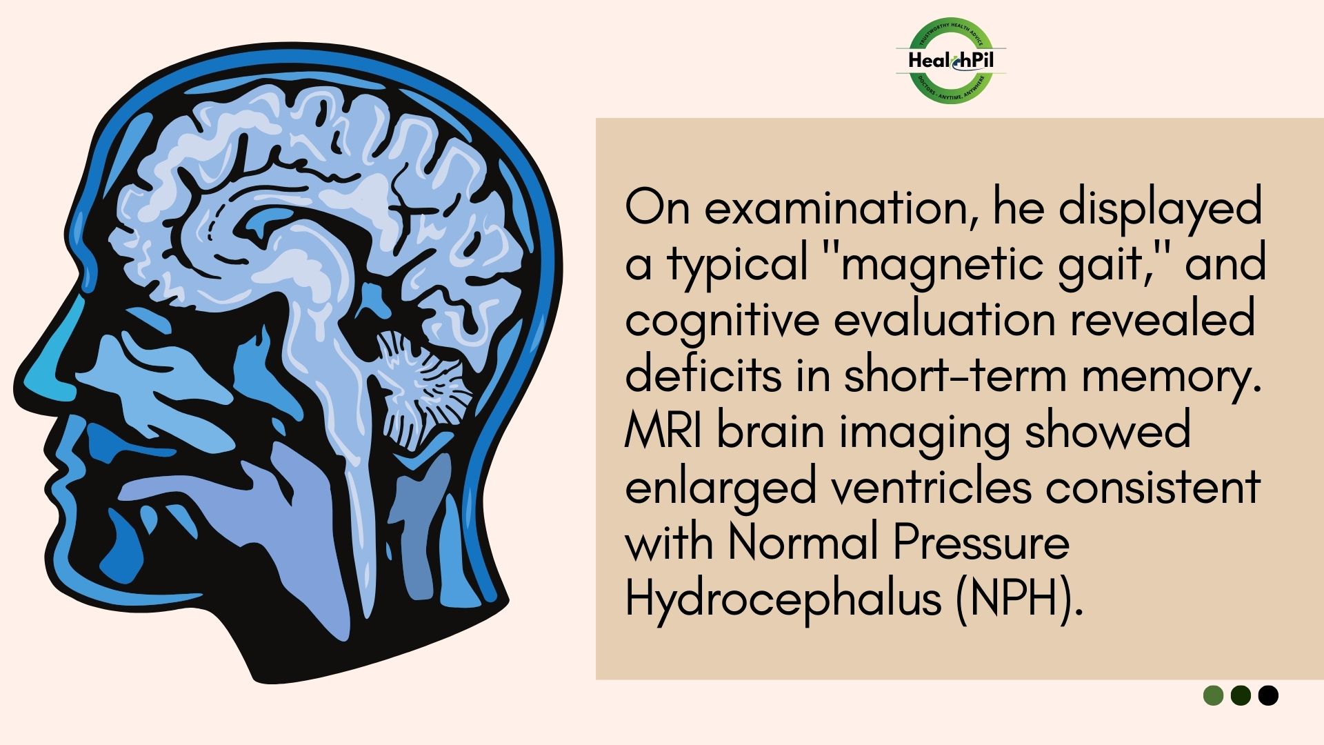 Normal pressure hydrocephalus