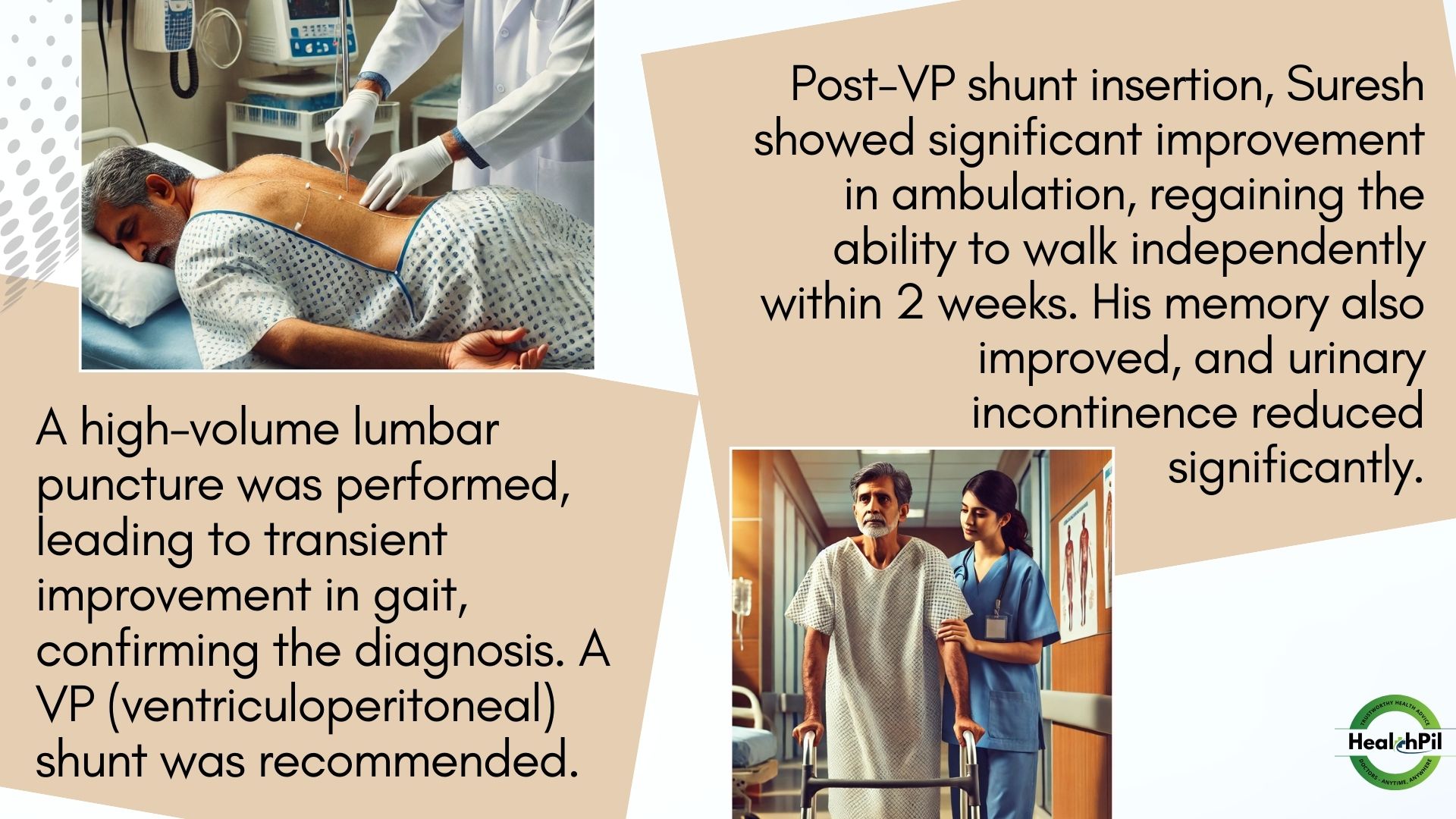 Post-VP shunt insertion.