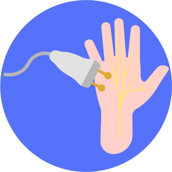 Nerve Conduction Studies