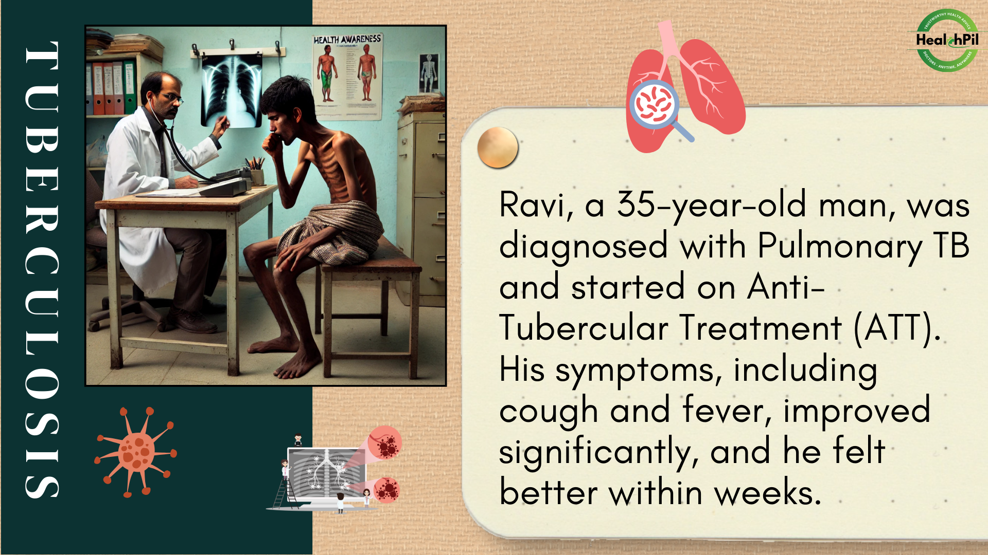 Tuberculosis