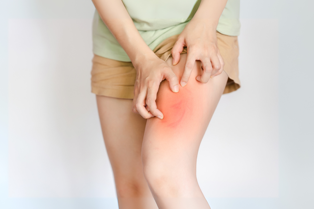 Muscle weakness