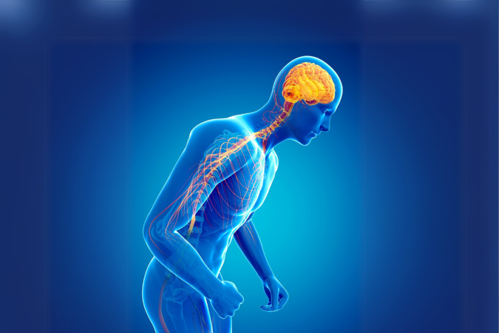 Parkinson's disease