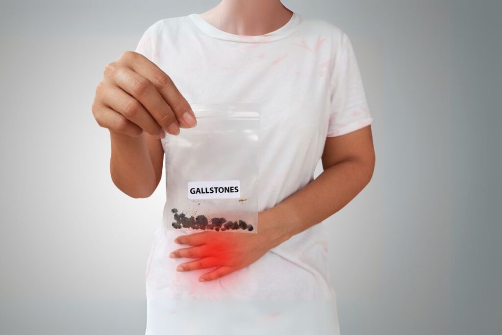 अगर आप सोच रहे हैं कि Gallstones सिर्फ दर्द देते हैं, तो सच जानकर चौंक जाएंगे!