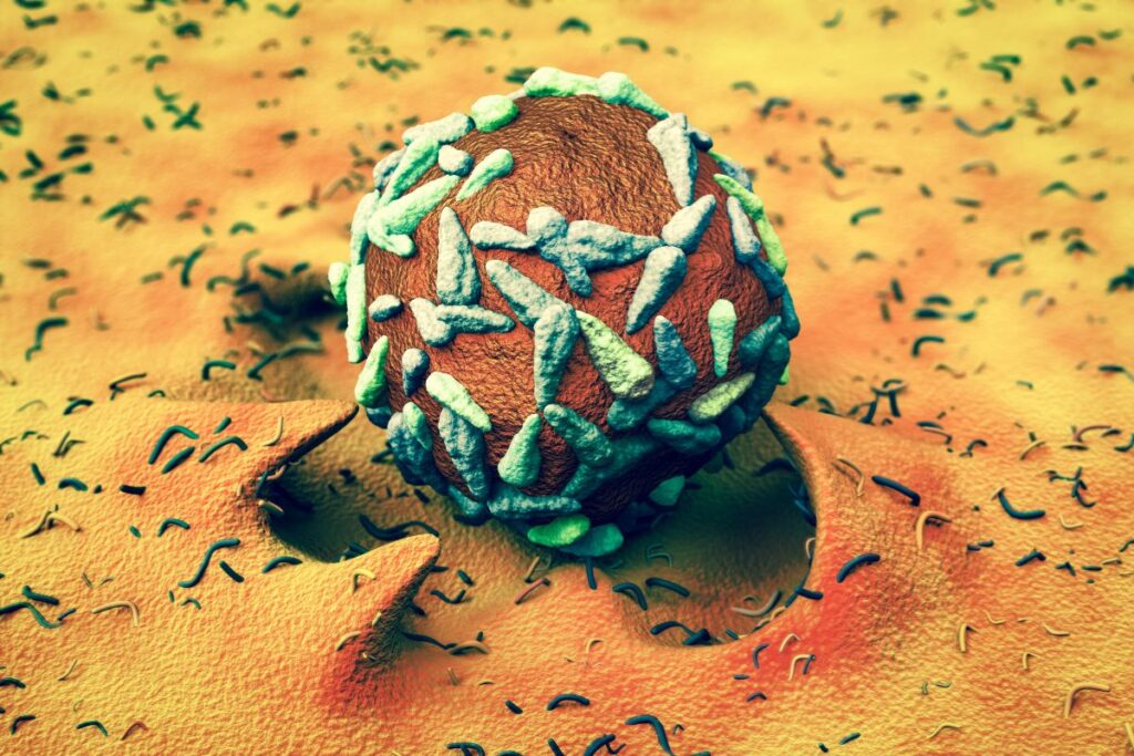 Colorectal Cancer: What You Need to Know About Symptoms, Screening, and Treatment