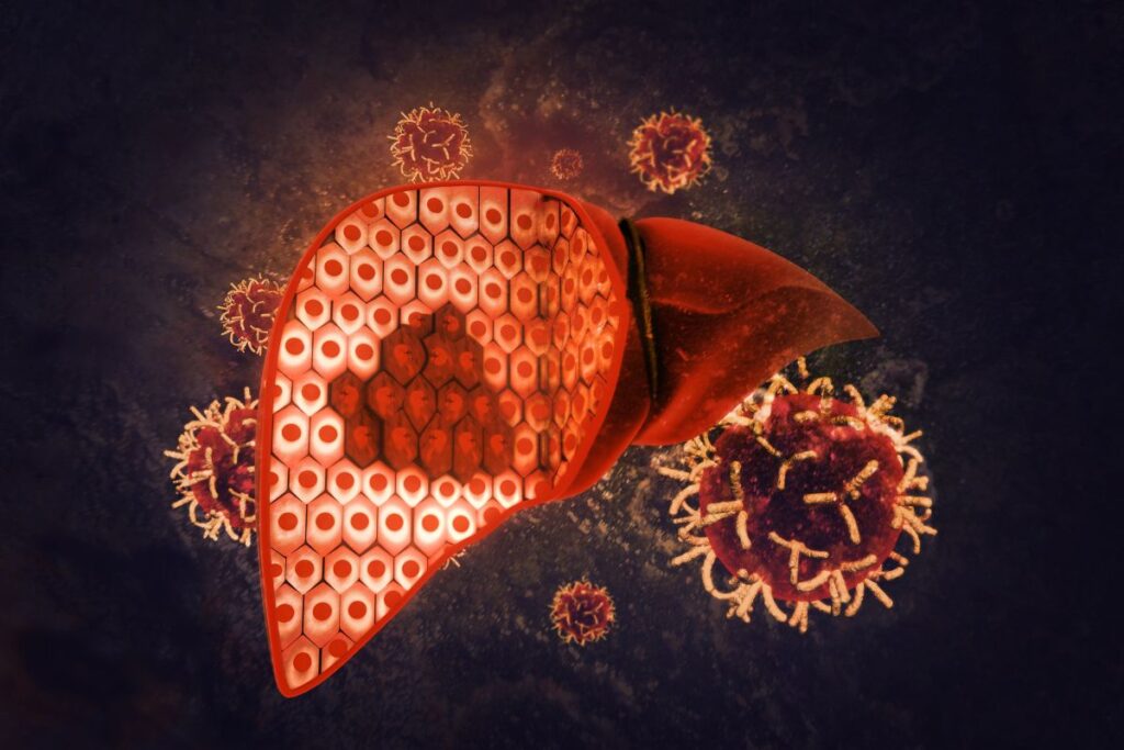 A Complete Guide on Liver Cancer: Symptoms, Screening, Prevention and Treatment