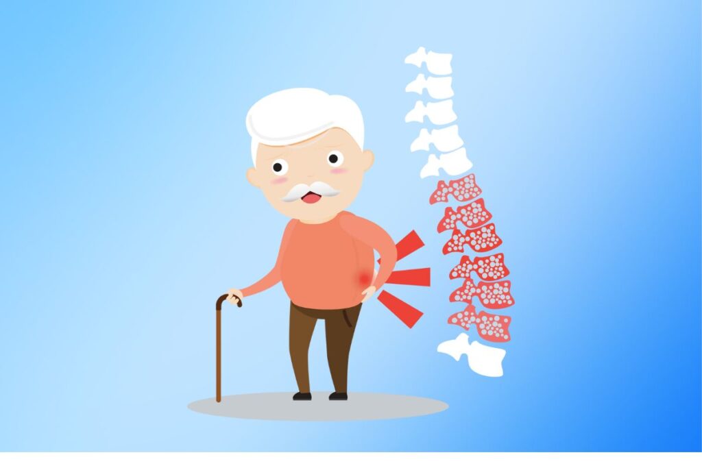 Is Your Bones’ Health at Risk? How Osteoporosis can increase your chances of Recurrent Fractures!