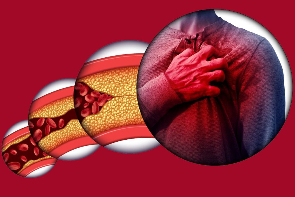 Heart Attack vs. Heart Failure: What's the Difference and How Can You Prevent Both?