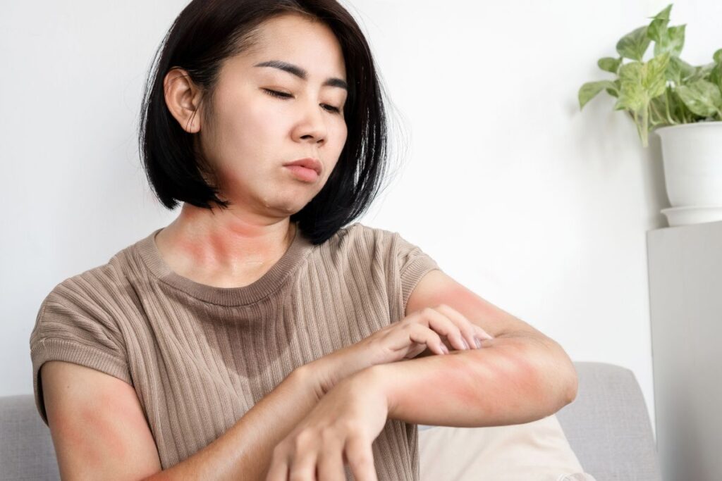 Frequent Skin Rashes and Allergies? Here's What You Need to Know and How to Fix It!