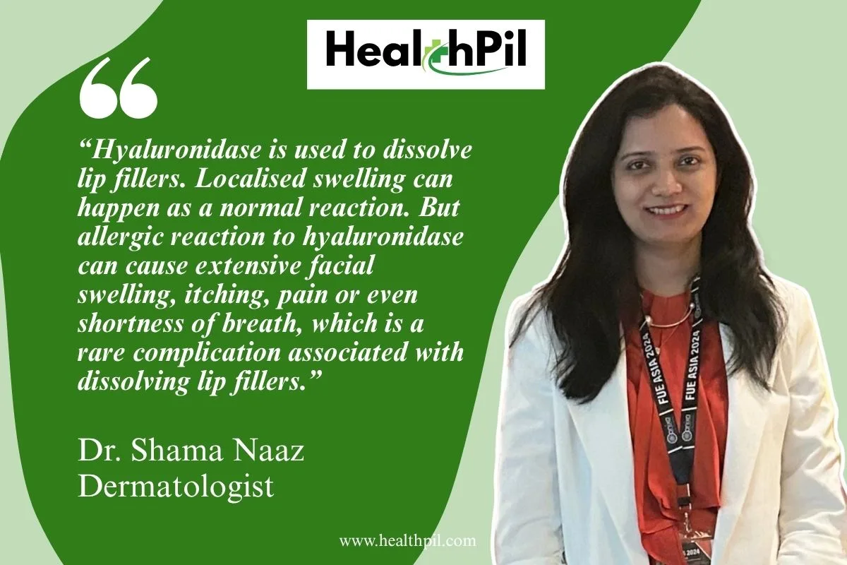 Hyaluronidase is used to dissolve lip fillers. Localised swelling can happen as a normal reaction